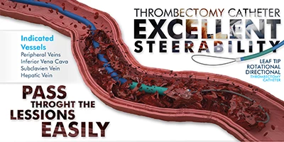 Mantis® Thrombectomy System