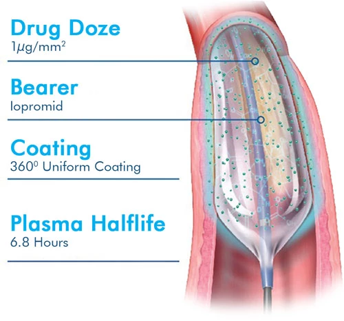 EXTENDER PTCA Drug Eluting Coronary Balloon Catheter-2