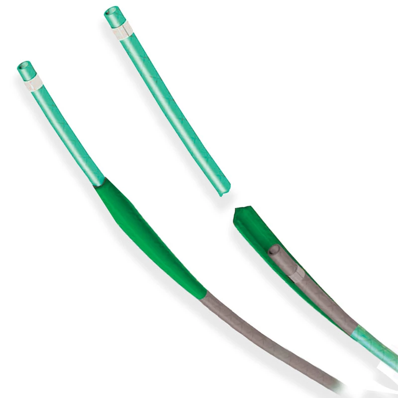 Pars Libro Catheter Laser Light Guided