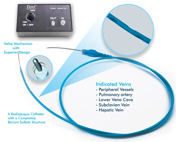 Dovi Thromboaspiration System-6